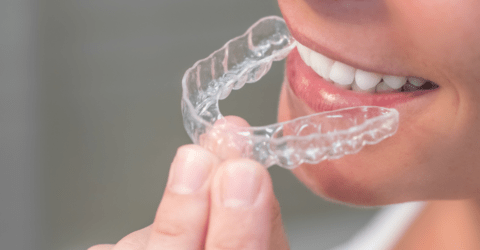 Alineamiento dental invisible