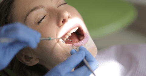 limpieza dental regular