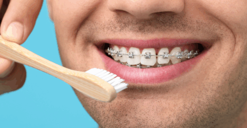 ortodoncia con periodontitis