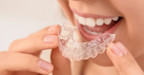 Pacient adulta somriu després de tractament d'ortodòncia invisible en clínica dental de Figueres