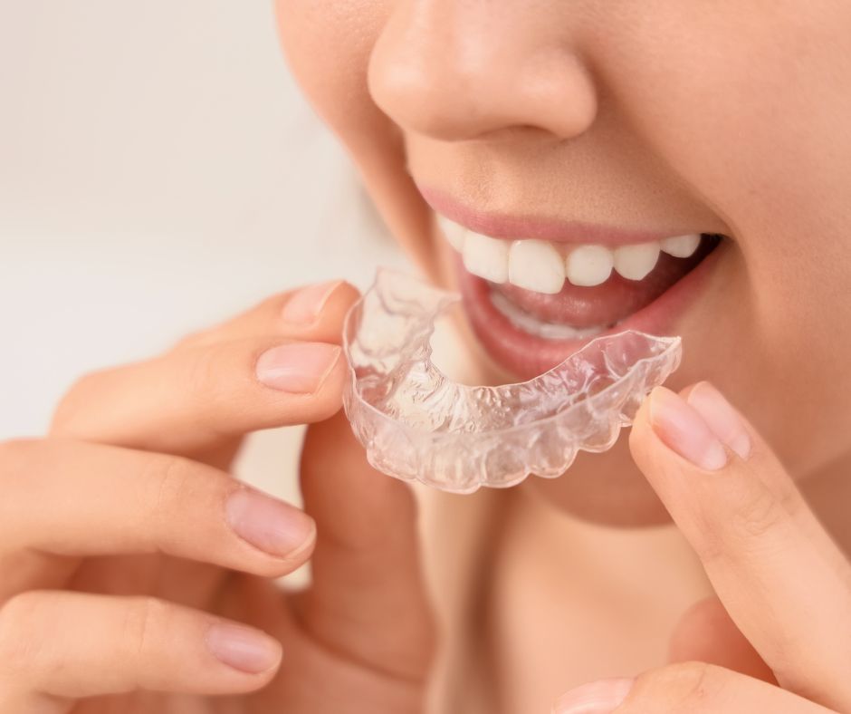 Pacient adulta somriu després de tractament d'ortodòncia invisible en clínica dental de Figueres